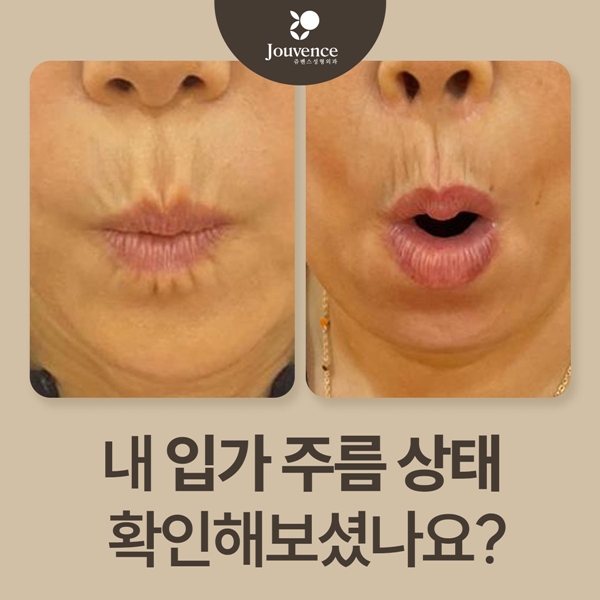 내 입가 주름 상태 확인해보셨나요